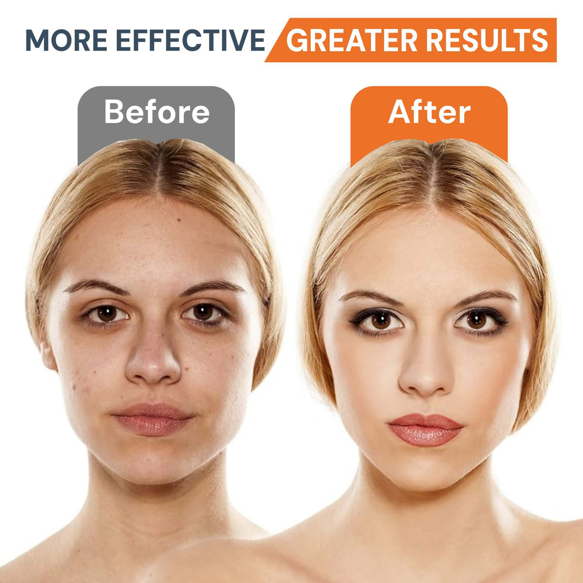 Face Massager - Anti-Aging, Skin Tightening & Wrinkle Reduction