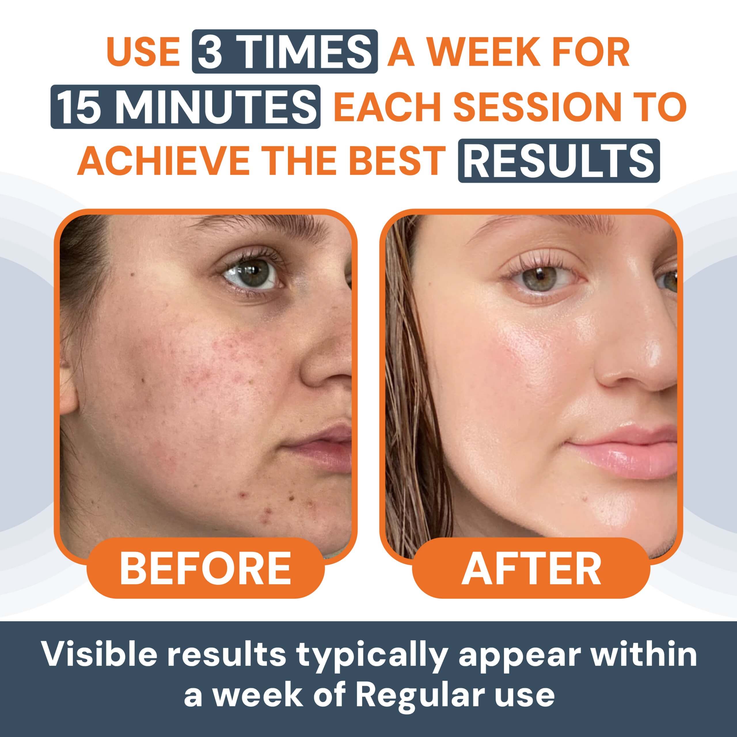 Face Massager - Anti-Aging, Skin Tightening & Wrinkle Reduction